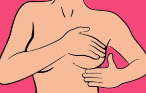 prevenir cáncer de mama